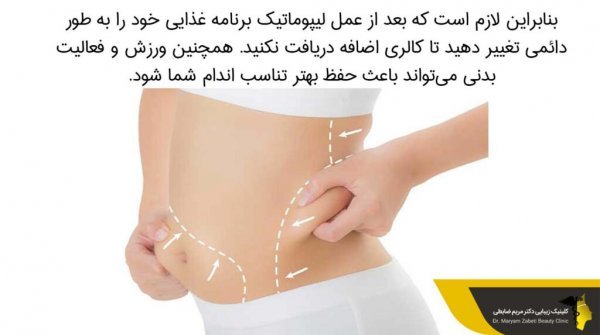  آیا بعد از اسلیو معده گشاد می‌شود+دوره نقاهت لیپوماتیک چقدر است+چه قرصی معده را کوچک می‌کند+بوتاکس معده برای چه وزنی است