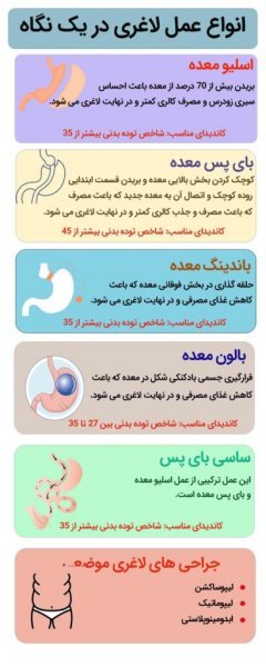 بعد از عمل اسلیو چقدر باید راه رفت+بوتاکس معده چگونه است+بوتاکس معده برای چه وزنی مناسب است+کدام عمل لاغری بدون بازگشت است