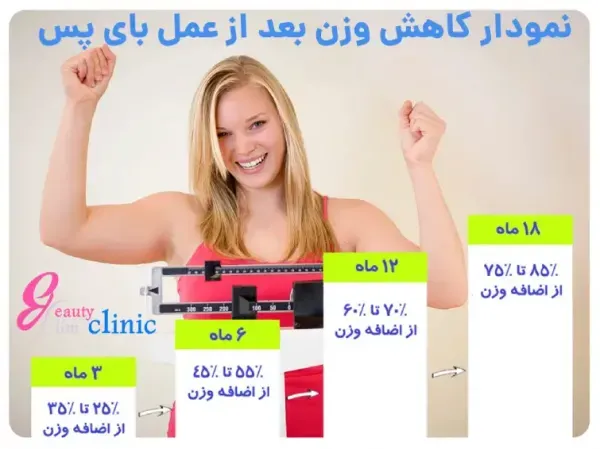  بعد از عمل اسلیو چقدر باید راه رفت+بوتاکس معده چگونه است+بوتاکس معده برای چه وزنی مناسب است+کدام عمل لاغری بدون بازگشت است