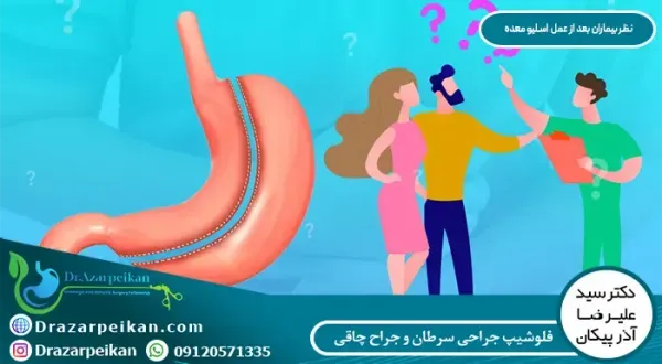 نظرات مردم درباره عمل اسلیو معده+نظرات مردم در مورد عمل معده+نظرات درباره عمل اسلیو معده+اسلیو معده برای چه کسانی خطرناک است