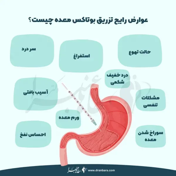  نظرات مردم درباره عمل اسلیو معده+نظرات مردم در مورد عمل معده+نظرات درباره عمل اسلیو معده+اسلیو معده برای چه کسانی خطرناک است