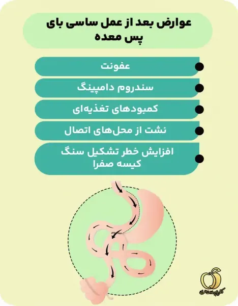  بعد از عمل بای پس چقدر وزن کم میکنیم+بعد از بای پس چه میوه هایی بخوریم+نظرات افرادی که بای پس انجام دادن+عوارض بوتاکس معده