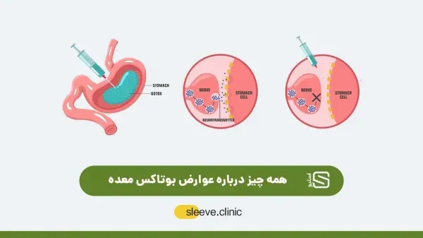  بعد از عمل بای پس چقدر وزن کم میکنیم+بعد از بای پس چه میوه هایی بخوریم+نظرات افرادی که بای پس انجام دادن+عوارض بوتاکس معده