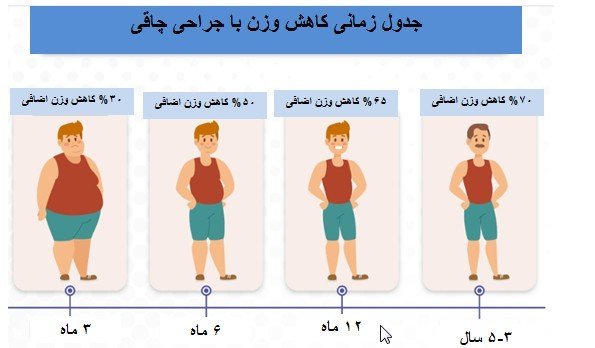  بعد از عمل بای پس چقدر وزن کم میکنیم+بعد از بای پس چه میوه هایی بخوریم+نظرات افرادی که بای پس انجام دادن+عوارض بوتاکس معده
