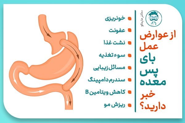 آیا بای‌پس معده عوارض دارد+چه آمپولی برای لاغری خوب است+آیا بالون معده عوارض دارد+نظرات درباره بالون معده