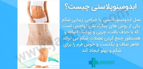  بعد از عمل بالن معده چی بخوریم+ابدو یا ابدومینوپلاستی چه عملی است+لیپوساکشن چگونه است+آیا عمل لیپوماتیک بیهوشی دارد