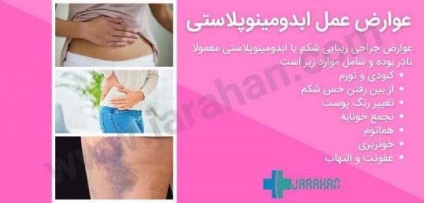  بعد از عمل بالن معده چی بخوریم+ابدو یا ابدومینوپلاستی چه عملی است+لیپوساکشن چگونه است+آیا عمل لیپوماتیک بیهوشی دارد