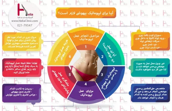  بعد از عمل بالن معده چی بخوریم+ابدو یا ابدومینوپلاستی چه عملی است+لیپوساکشن چگونه است+آیا عمل لیپوماتیک بیهوشی دارد