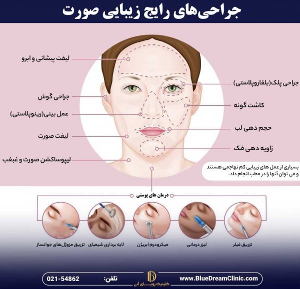  نظرات در مورد لیپوساکشن+نظرات در مورد لیپوساکشن غبغب+فیلم ساکشن غبغب+چرا بعد از ساکشن غبغب باید گن بست