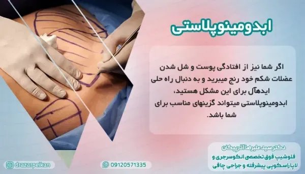  نظرات در مورد لیپوساکشن+نظرات در مورد لیپوساکشن غبغب+فیلم ساکشن غبغب+چرا بعد از ساکشن غبغب باید گن بست