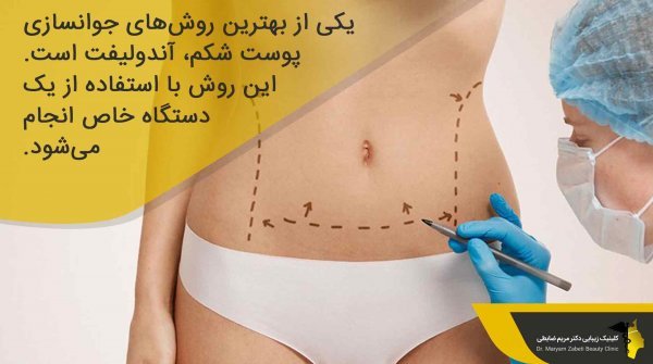  عکس قبل و بعد عمل لیپو ابدو+عکس لیفت شکم بدون جراحی+هزینه برداشتن چربی شکم بدون جراحی+فیلم دستگاه لاغری شکم