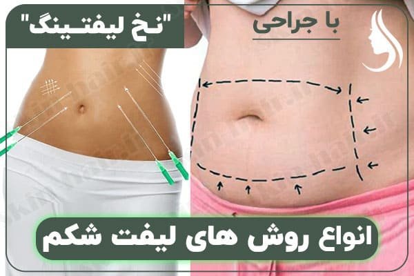  عکس قبل و بعد عمل لیپو ابدو+عکس لیفت شکم بدون جراحی+هزینه برداشتن چربی شکم بدون جراحی+فیلم دستگاه لاغری شکم