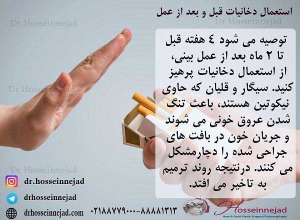  چقدر قبل از عمل نباید سیگار کشید+بعد از عمل ابدو چه لباسی بپوشیم+چرا بعد عمل ابدو شکم ورم دارد+چه مدت بعد از ابدو میتوان سکس داشت