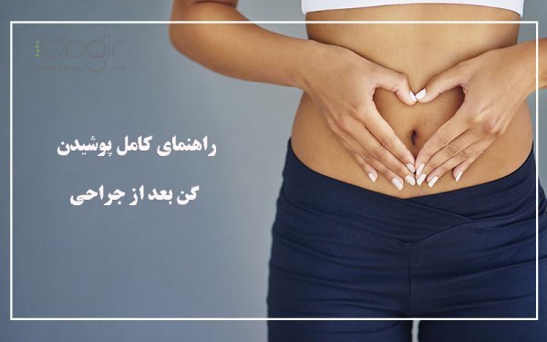  چقدر قبل از عمل نباید سیگار کشید+بعد از عمل ابدو چه لباسی بپوشیم+چرا بعد عمل ابدو شکم ورم دارد+چه مدت بعد از ابدو میتوان سکس داشت