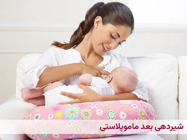  عمل ماموپلاستی چقدر طول میکشد+آیا بعدماموپلاستی می‌توان رابطه داشت+ماموپلاستی با بیمه تکمیلی انجام می‌شود+ماموپلاستی و شیردهی