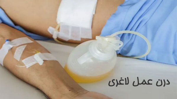  آیا گذاشتن و کشیدن درن درد دارد+درن چقدر در بدن می‌ماند+عمل لیفت سینه چگونه است+برای خوب شدن جای درن چه باید کرد