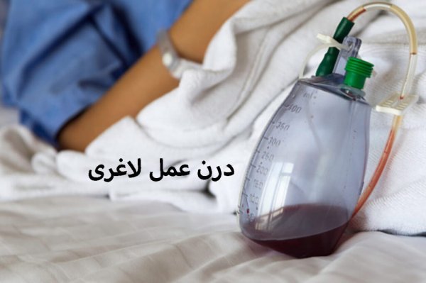  آیا گذاشتن و کشیدن درن درد دارد+درن چقدر در بدن می‌ماند+عمل لیفت سینه چگونه است+برای خوب شدن جای درن چه باید کرد