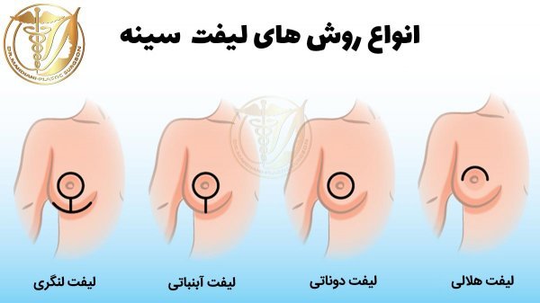  آیا گذاشتن و کشیدن درن درد دارد+درن چقدر در بدن می‌ماند+عمل لیفت سینه چگونه است+برای خوب شدن جای درن چه باید کرد