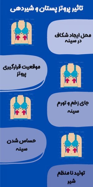  پروتز سينه چیست+جراحی پروتز سینه ارزان+قیمت پروتز سینه زنان+عوارض پروتز سینه زنان+سولاریوم و پروتز سینه