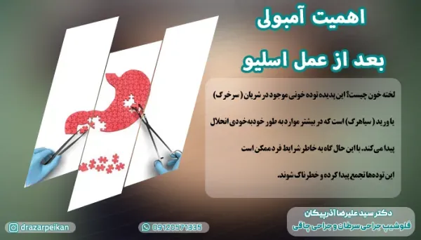 خطر آمبولی تا چند روز بعد از عمل اسلیو است