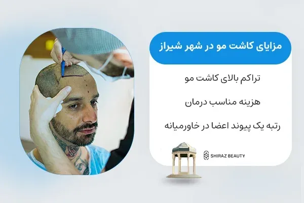  کاشت مو در کدام شهر بهتر است+کاشت مو در تهران بهتر است یا شیراز
