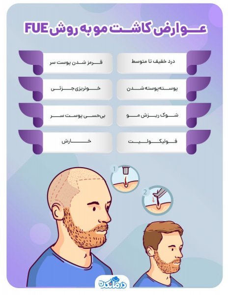  فیلم کاشت مو از بدن به سر + کاشت مو از زیر بغل