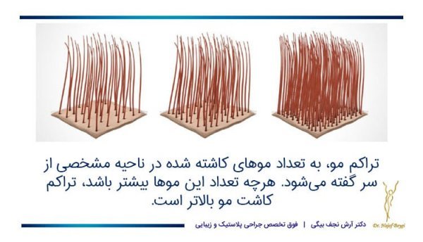  فیلم کاشت مو از بدن به سر + کاشت مو از زیر بغل