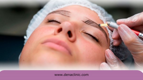  فیلم برداشت مو برای کاشت ابرو+نظرات در مورد کاشت ابرو