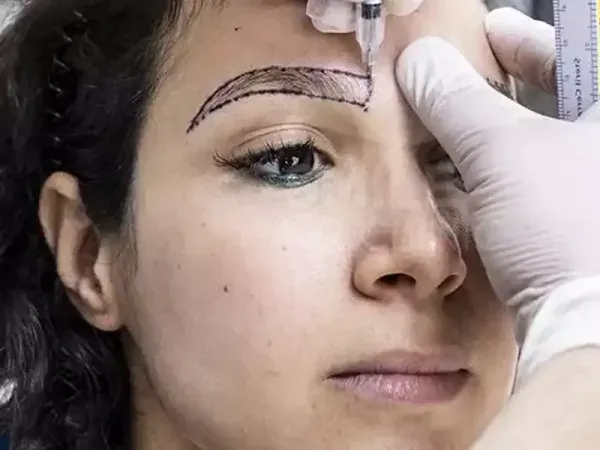  چرا بعد از کاشت ابرو نباید رابطه جنسی سکس داشت