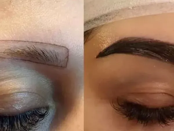  چرا بعد از کاشت ابرو نباید رابطه جنسی سکس داشت