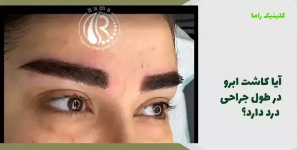  چرا بعد از کاشت ابرو نباید رابطه جنسی سکس داشت