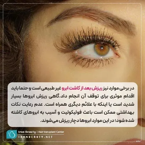 چه مدت بعد از کاشت ابرو ریزش شروع می‌شود