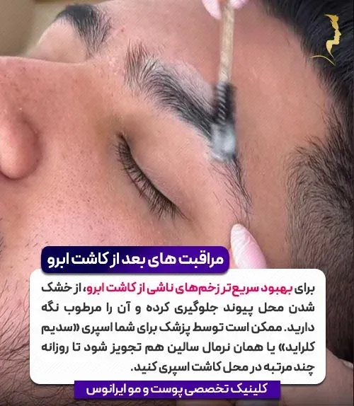  چه مدت بعد از کاشت ابرو ریزش شروع می‌شود