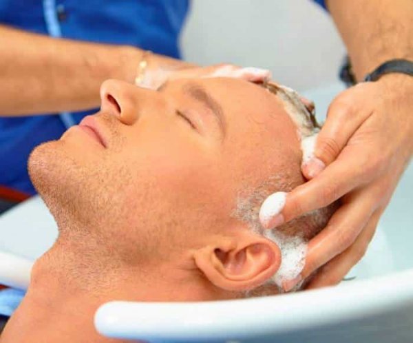  فیلم و عکس کندن دلمه های کاشت مو