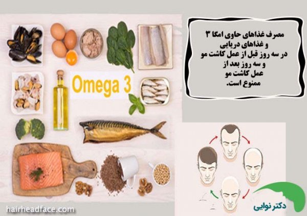  فیلم و عکس کندن دلمه های کاشت مو