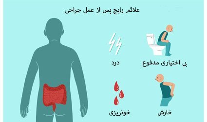  عکس قبل و بعد از عمل بواسیر + بواسیر چیست با عکس
