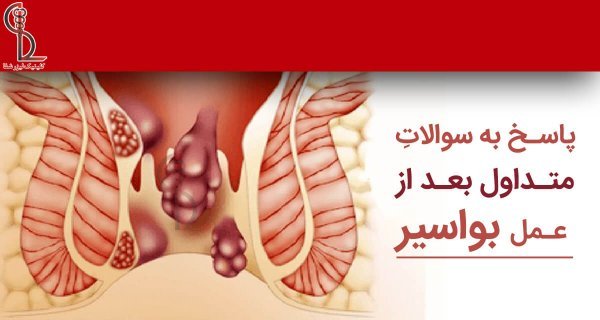  بعد از عمل بواسیر چه بخوریم