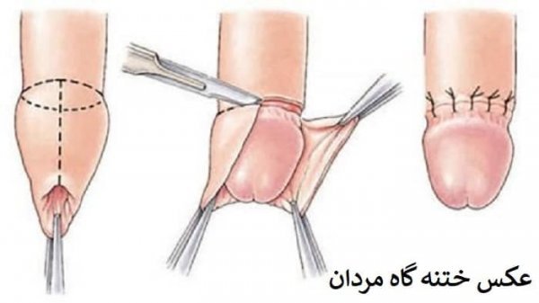  عکس چیز مرد واقعی + آلت تناسلی مردان + اندازه طبیعی آلت تناسلی مردان