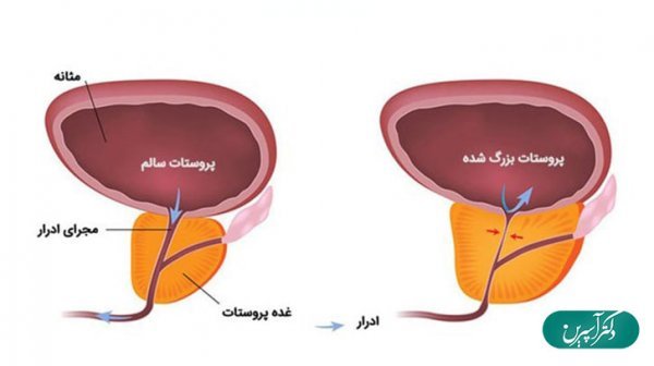  عکس چیز مرد واقعی + آلت تناسلی مردان + اندازه طبیعی آلت تناسلی مردان