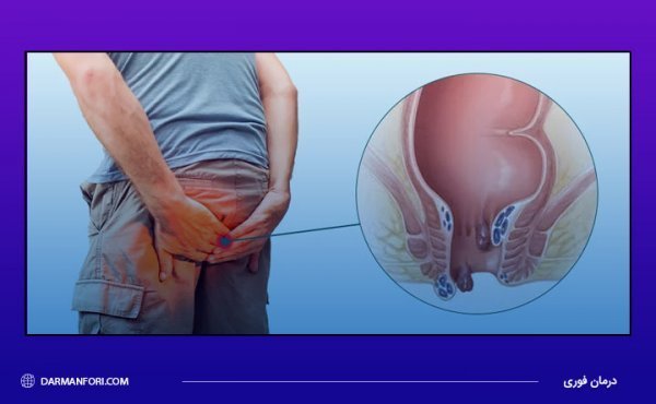  شیاف گلیسیرین بعد از چند دقیقه اثر میکند