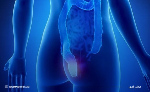  شیاف گلیسیرین بعد از چند دقیقه اثر میکند