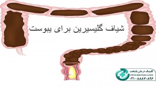  شیاف گلیسیرین بعد از چند دقیقه اثر میکند