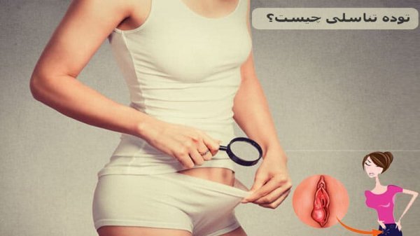  عکس توده سفت زیر پوست در ناحیه تناسلی مرد