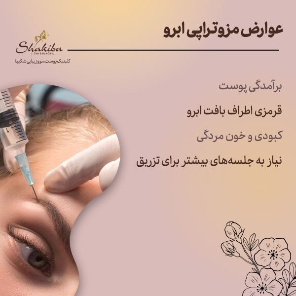  عکس مزوتراپی ابرو + چه مدت بعد از کاشت ابرو باید مزوتراپی کرد