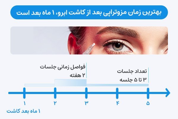  عکس مزوتراپی ابرو + چه مدت بعد از کاشت ابرو باید مزوتراپی کرد