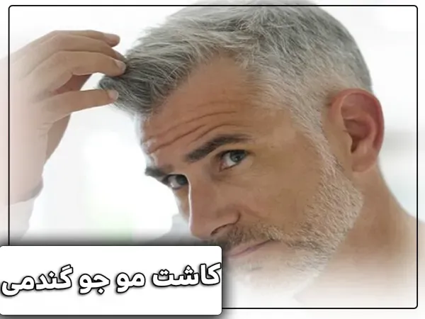 آیا موی سفید را میتوان کاشت