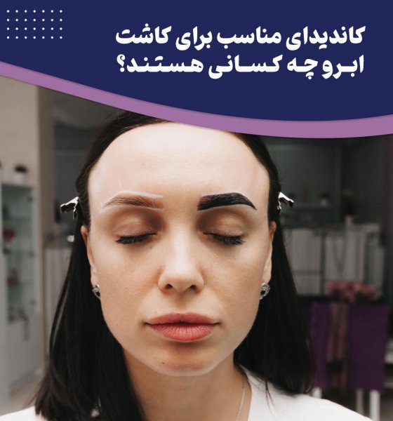 چه کسانی کاندید مناسب برای کاشت ابرو هستند