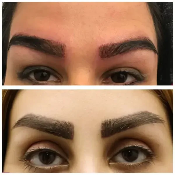  چه کسانی کاندید مناسب برای کاشت ابرو هستند