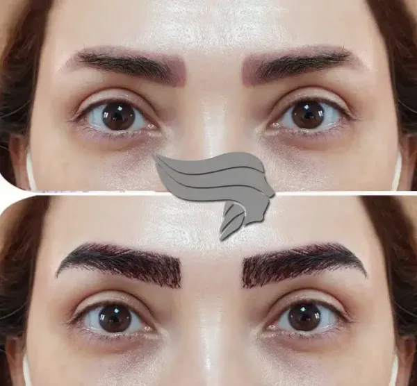 فیلم کاشت ابرو از صفر تا صد + قبل از کاشت ابرو چه داروهایی نباید خورد