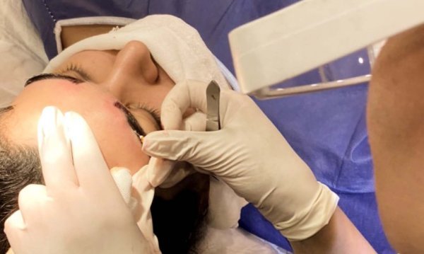  فیلم کاشت ابرو از صفر تا صد + قبل از کاشت ابرو چه داروهایی نباید خورد